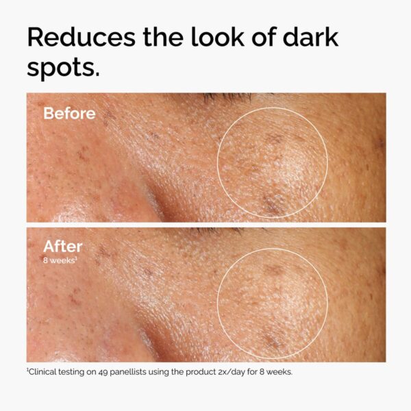 The Ordinary Alpha Arbutin 2% + HA