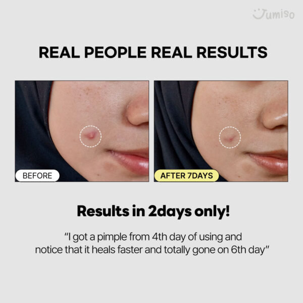 Jumiso Snail Mucin 95% + Peptide Facial Essence