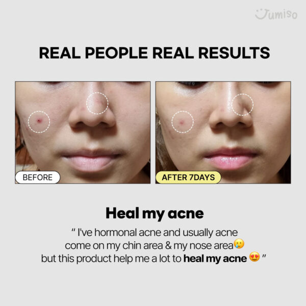 Jumiso Snail Mucin 95% + Peptide Facial Essence