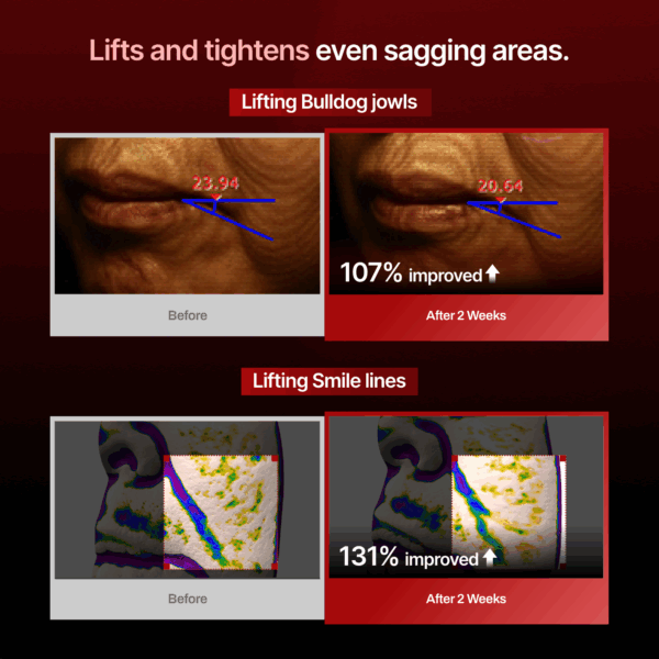 Meditherapy Wrinkle Fit Needle Face Roller