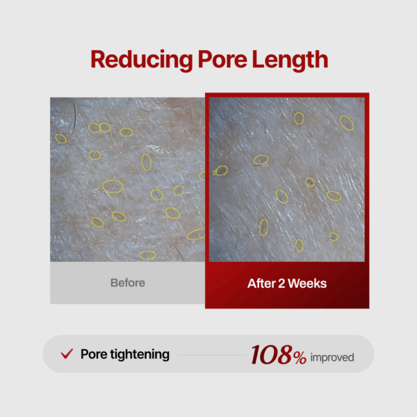 Meditherapy Wrinkle Fit Needle Face Roller