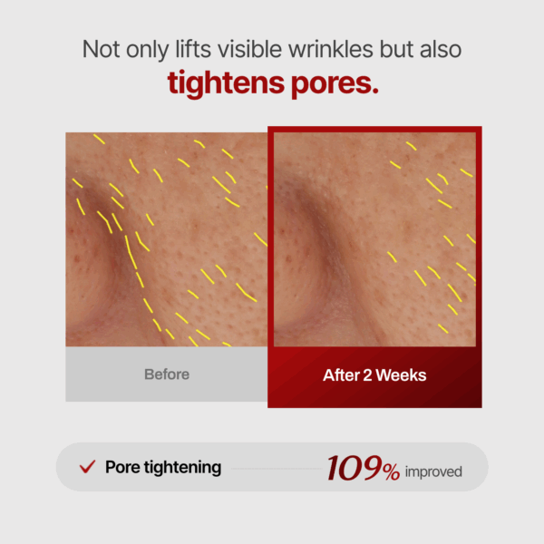 Meditherapy Wrinkle Fit Needle Face Roller