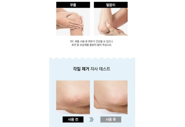 TOSOWOONG - All Kill Exfoliating Gloves