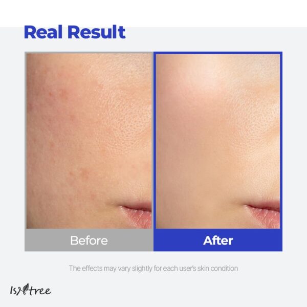 IsNtree Hyaluronic Acid Aqua Gel Cream