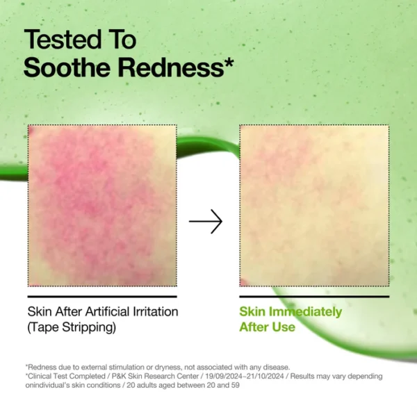 Anua Azelaic Acid 10+ Hyaluron Redness Soothing Serum